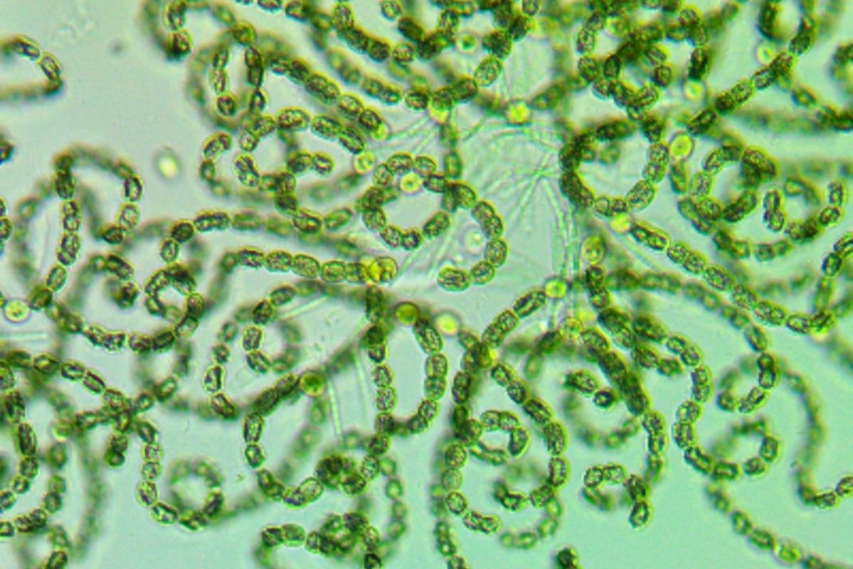 Microcystis sp.